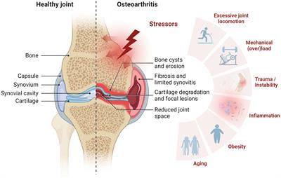 Fibrotic pathways and fibroblast-like synoviocyte phenotypes in osteoarthritis